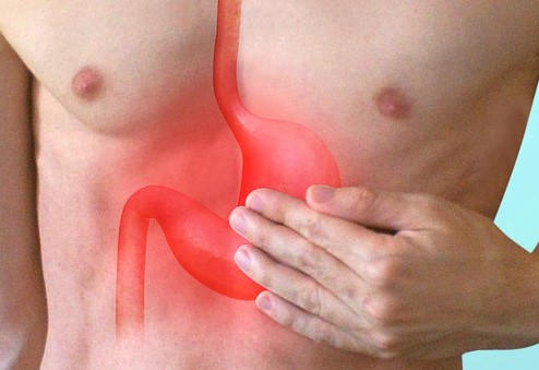 Reflux - brandend maagzuur focus